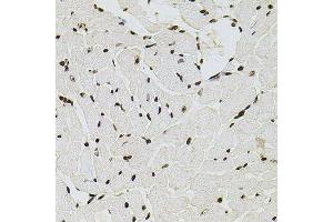Immunohistochemistry of paraffin-embedded mouse heart using HIST1H2AG antibody (ABIN6003627) at dilution of 1/100 (40x lens).