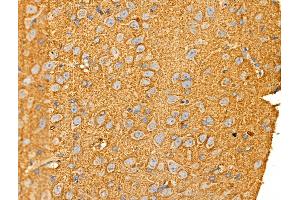 ABIN6258684 and ABIN6274829 at 1/100 staining Rat brain tissue by IHC-P. (AKR1E2 anticorps  (Internal Region))