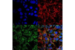 Immunocytochemistry/Immunofluorescence analysis using Rabbit Anti-BDNF Polyclonal Antibody . (BDNF anticorps  (N-Term) (APC))