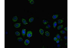 Immunofluorescent analysis of A549 cells using ABIN7171008 at dilution of 1:100 and Alexa Fluor 488-congugated AffiniPure Goat Anti-Rabbit IgG(H+L)
