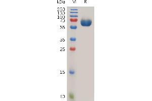 Human CD142 Protein, hFc Tag on SDS-PAGE under reducing condition.