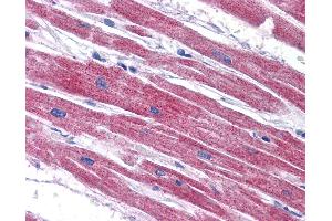Anti-NDUFAF2 antibody IHC of human heart.