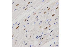Immunohistochemistry of paraffin-embedded rat heart using PELP1 antibody (ABIN6292223) at dilution of 1:200 (40x lens). (PELP1 anticorps)