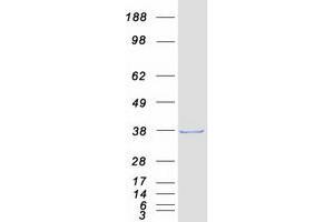 Validation with Western Blot