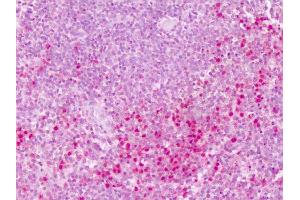 Anti-PTPRE antibody IHC of human spleen.