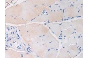 Detection of FBN1 in Mouse Skeletal muscle Tissue using Polyclonal Antibody to Fibrillin 1 (FBN1)