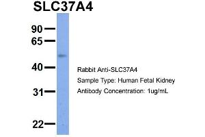 Host:  Rabbit  Target Name:  SLC37A4  Sample Type:  Human Fetal Kidney  Antibody Dilution:  1.