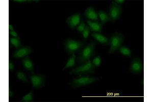 Immunofluorescence of monoclonal antibody to OXSR1 on HeLa cell. (OXSR1 anticorps  (AA 1-527))