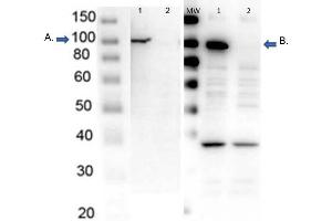Western Blot of endogenous PARP1 with Rabbit Anti-PARP1 Antibodies Western Blot of endogenous PARP1 with Rabbit Anti-PARP1 Antibodies.