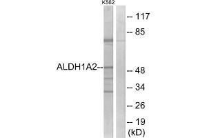 Western blot analysis of extracts from K562 cells, using ALDH1A2 antibody.