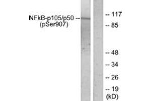 Western blot analysis of extracts from HeLa cells treated with TNF-alpha, using NF-kappaB p105/p50 (Phospho-Ser907) Antibody. (NFKB1 anticorps  (pSer907))
