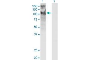 Western Blot analysis of TRPC5 expression in transfected 293T cell line by TRPC5 monoclonal antibody (M10), clone 1C8.