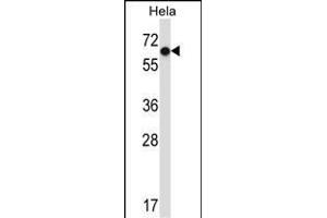 NR0B1 Antibody (Center) (ABIN657696 and ABIN2846687) western blot analysis in Hela cell line lysates (35 μg/lane). (NR0B1 anticorps  (AA 304-333))