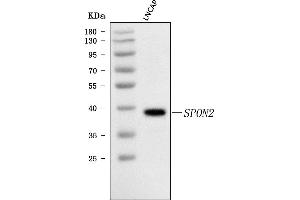 Western blot analysis of SPON2 using anti-SPON2 antibody (ABIN7601976).