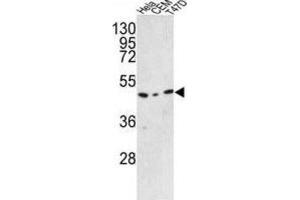 Western Blotting (WB) image for anti-Chromosome 9 Open Reading Frame 156 (C9orf156) antibody (ABIN3002894) (C9orf156 anticorps)