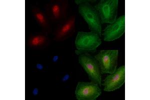 ABIN6257561 and ABIN6274179 staining  cells by IF/ICC. (ZNF18 anticorps  (C-Term))