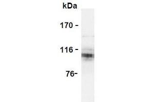 Western Blotting (WB) image for anti-Amyloid beta (A4) Precursor Protein (APP) (AA 18-38) antibody (ABIN1449275)