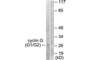 Western blot analysis of extracts from Jurkat cells, using Cyclin G Antibody. (Cyclin G1 anticorps  (AA 161-210))