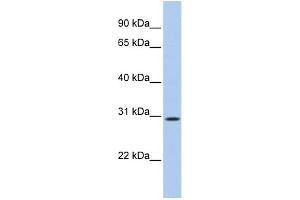 WB Suggested Anti-C20orf10 Antibody Titration: 0. (TP53TG5 anticorps  (N-Term))