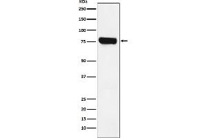 Western blot analysis of HEC1 expression in Jurkat cell lysate.