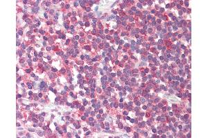 Anti-FTHFSDC1 / MTHFD1L antibody IHC staining of human tonsil. (MTHFD1L anticorps  (AA 578-591))