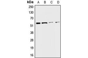 Western blot analysis of CHRNA3 expression in A549 (A), HepG2 (B), mouse liver (C), rat kidney (D) whole cell lysates. (CHRNA3 anticorps  (Center))