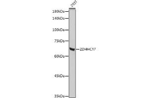 Western blot analysis of extracts of 293T cells, using ZDHHC17 antibody (ABIN6130455, ABIN6150416, ABIN6150417 and ABIN6222540) at 1:1000 dilution.