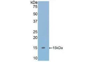 WB of Protein Standard: different control antibodies against Highly purified E. (TGFB1 Kit CLIA)