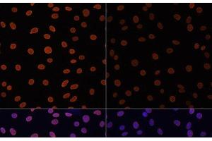 Immunofluorescence analysis of C6 cells using Acetyl-Histone H4-K12 Polyclonal Antibody at dilution of 1:100. (Histone H4 anticorps  (acLys12))