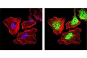 Immunofluorescence (IF) image for anti-Keratin 5 (KRT5) antibody (ABIN1106933)
