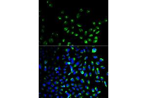 Immunofluorescence analysis of HeLa cell using UCHL1 antibody. (UCHL1 anticorps)