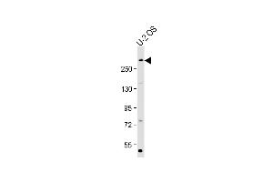 Anti-E at 1:2000 dilution + U-2 OS whole cell lysate Lysates/proteins at 20 μg per lane. (p300 anticorps  (Ser1834))