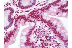 anti-Heterogeneous Nuclear Ribonucleoprotein A3 (HNRNPA3) (AA 30-57) antibody