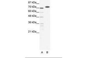 Image no. 1 for anti-RB-Associated KRAB Zinc Finger (RBAK) (AA 447-496) antibody (ABIN202880) (RBAK anticorps  (AA 447-496))