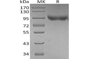 Platelet/endothelial Cell Adhesion Molecule (PECAM1) protein (His tag)
