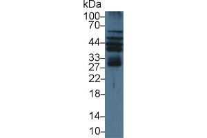 Detection of RAGE in Human Hela cell lysate using Polyclonal Antibody to Renal Tumor Antigen (RAGE)
