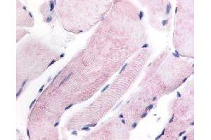 Immunohistochemical (Formalin/PFA-fixed paraffin-embedded sections) staining in human skeletal muscle with WNK1 polyclonal antibody . (WNK1 anticorps)