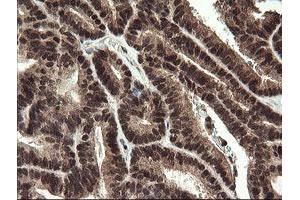 Image no. 6 for anti-Replication Factor C (Activator 1) 2, 40kDa (RFC2) (AA 1-234) antibody (ABIN1490617)