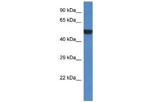 WB Suggested Anti-Porcn Antibody Titration: 1. (PORCN anticorps  (Middle Region))