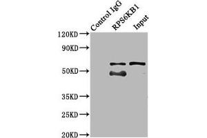 Immunoprecipitating RPS6KB1 in MCF-7 whole cell lysate Lane 1: Rabbit control IgG (1 μg) instead of ABIN7168196 in MCF-7 whole cell lysate.