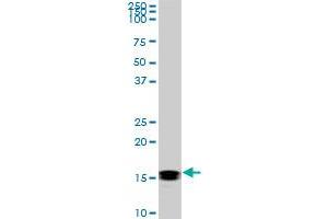 NME2 monoclonal antibody (M06), clone 1D3.