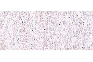 Immunohistochemistry of paraffin-embedded Human brain tissue using SMPD2 Polyclonal Antibody at dilution of 1:90(x200) (SMPD2 anticorps)