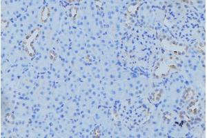 ABIN6279577 at 1/100 staining Mouse kidney tissue by IHC-P. (NDUFB7 anticorps  (Internal Region))