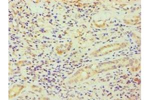 Immunohistochemistry of paraffin-embedded human kidney tissue using ABIN7164363 at dilution of 1:100 (DDX5 anticorps  (AA 1-290))