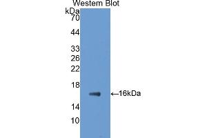 Detection of Recombinant GAD1, Rat using Polyclonal Antibody to Glutamate Decarboxylase 1, Brain (GAD1) (GAD anticorps  (AA 1-97))