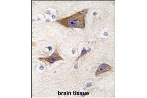 Formalin-fixed and paraffin-embedded human brain tissue reacted with LGR5/GPR49 antibody (Center) f , which was peroxidase-conjugated to the secondary antibody, followed by DAB staining.