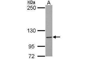 WB Image Sample (30 ug of whole cell lysate) A: MCF-7 5% SDS PAGE antibody diluted at 1:1000
