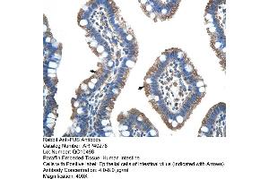 Rabbit Anti-FUS Antibody  Paraffin Embedded Tissue: Human Intestine Cellular Data: Epithelial cells of intestinal villas Antibody Concentration: 4. (FUS anticorps  (N-Term))