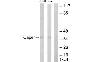 Immunohistochemistry analysis of paraffin-embedded human brain tissue using Caper antibody. (RBM39 anticorps  (Internal Region))