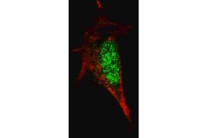 Fluorescent confocal image of SY5Y cells stained with SOX2 antibody. (SOX2 anticorps)
